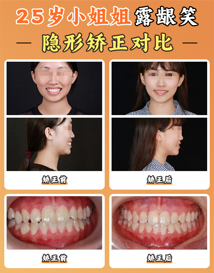 賈培增醫(yī)生看牙口碑評測：患者真實反饋與同行評價