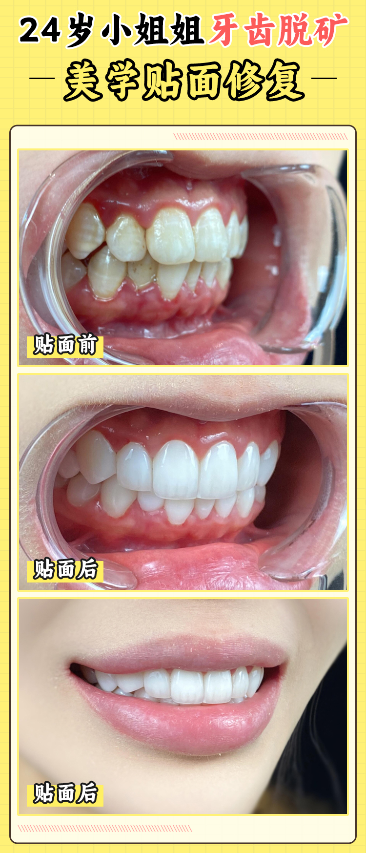 徐寶華醫(yī)生工作室在哪？豐聯(lián)麗菁口腔的高端診療體驗