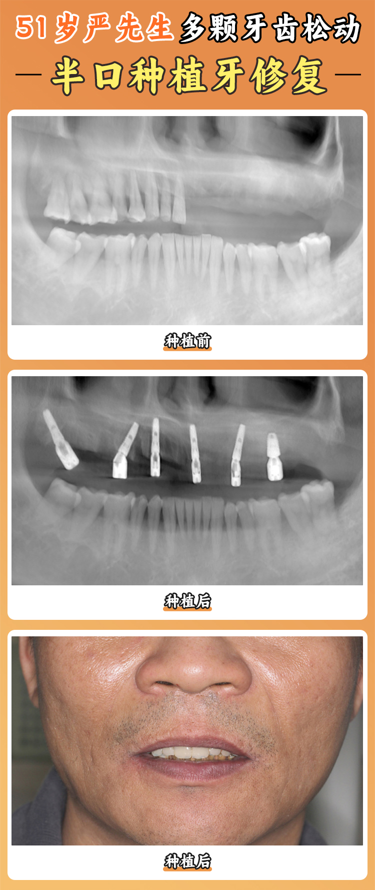 徐寶華醫(yī)生口碑如何？業(yè)內(nèi)名咖的評價更具說服力