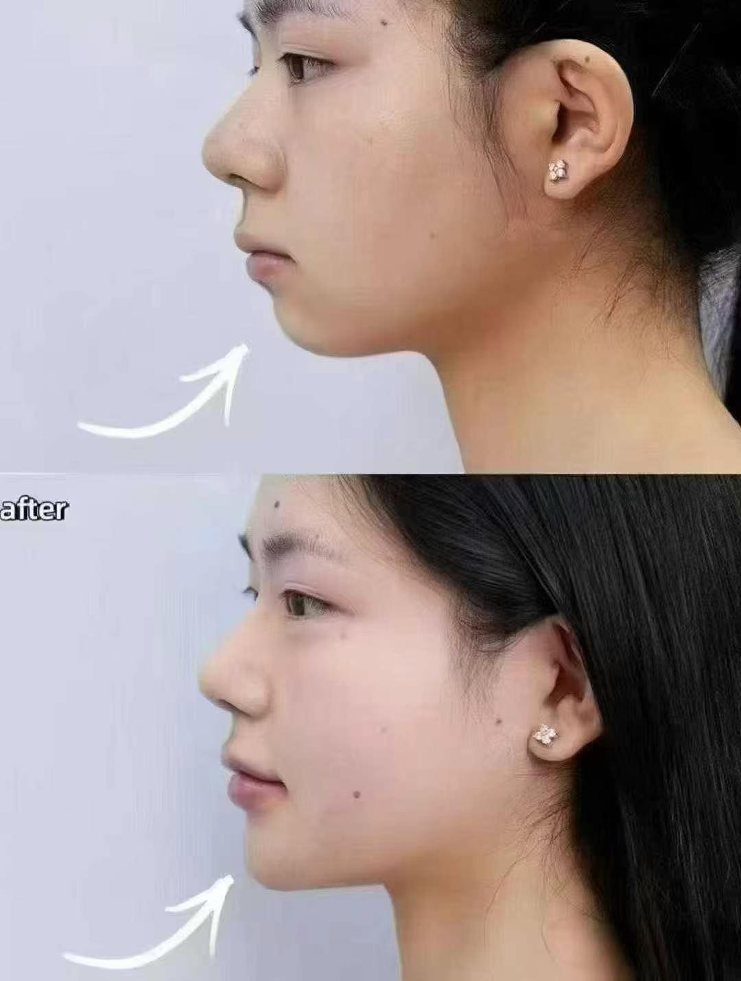 吴尽红医生怎么样？对比吴红巾吴红宣，看其复杂病例矫治、隐形矫正及早期干预技术与口碑究竟如何