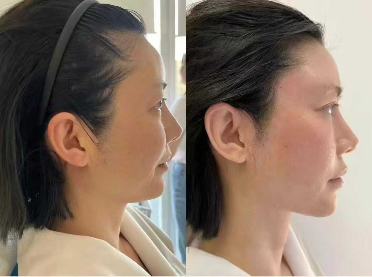 吴尽红医生对比吴红巾医生，核心技术优势有何不同？