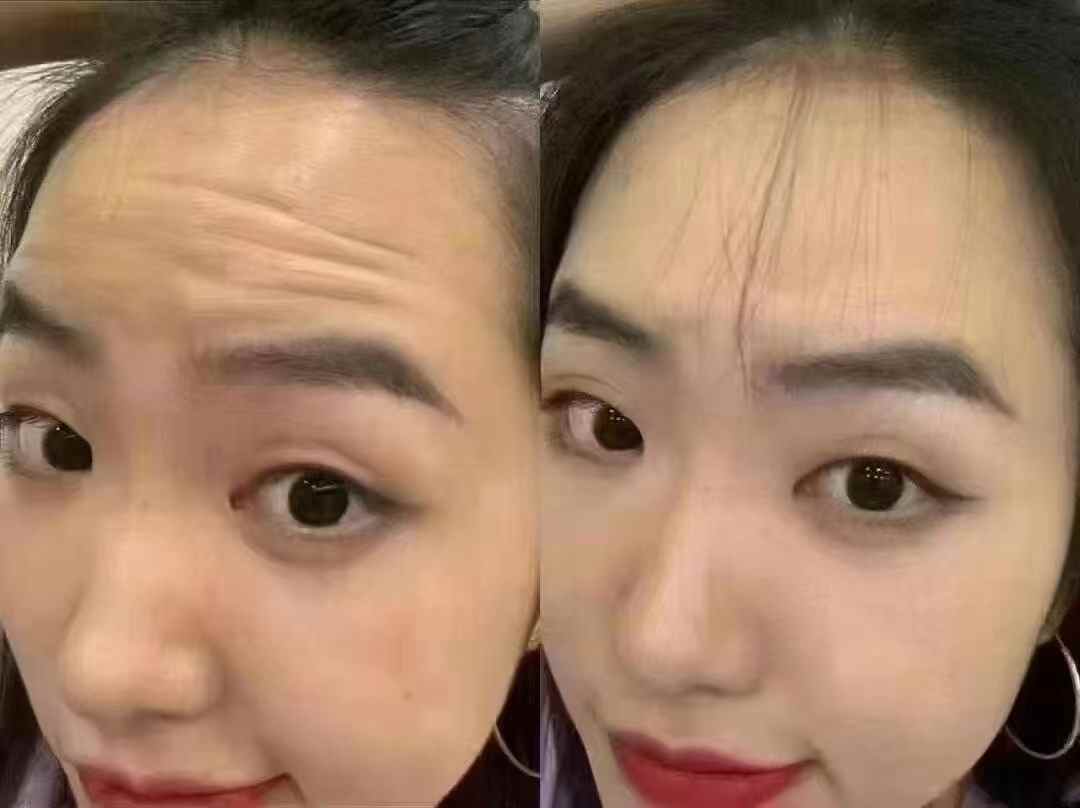 吴尽红医生隐形矫治技术怎么样？儿童与成人正畸方案有何差异？