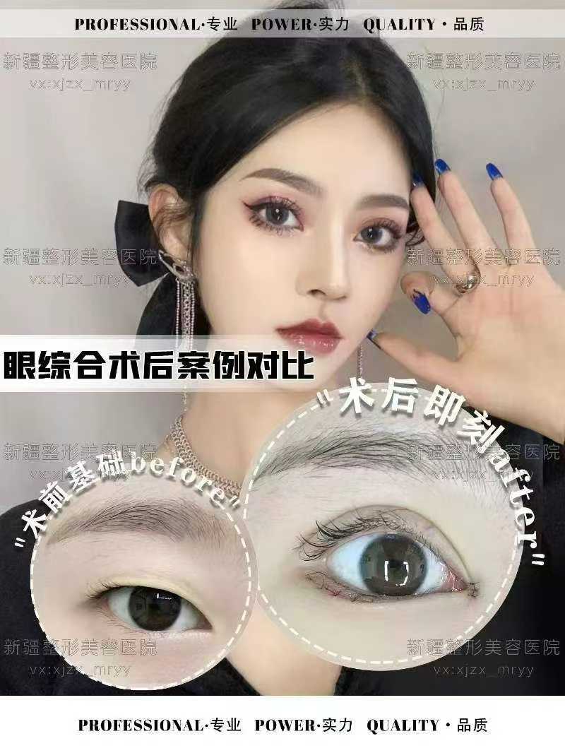 吴尽红医生对比吴锦红、吴红革医生，早期预防性矫治技术有何独特之处？