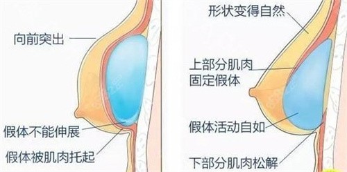 北京贺天遥医生丰胸