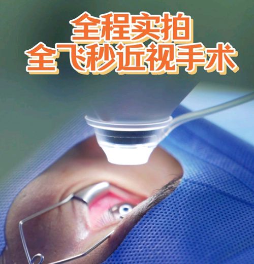 北京民眾眼科醫(yī)院收費(fèi)透明