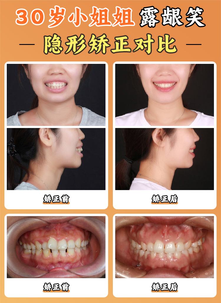 珠海市六和口腔医院和仁爱哪家好？技术、服务、价格全方位对比助你选优！ 