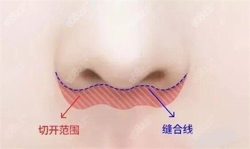 人中缩短卡通图展示.jpg