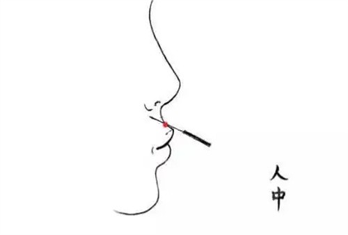 人中加深玻尿酸.jpg