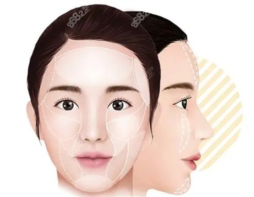 饅化臉需要修復(fù)部位圖解 饅化臉需要修復(fù)部位圖解