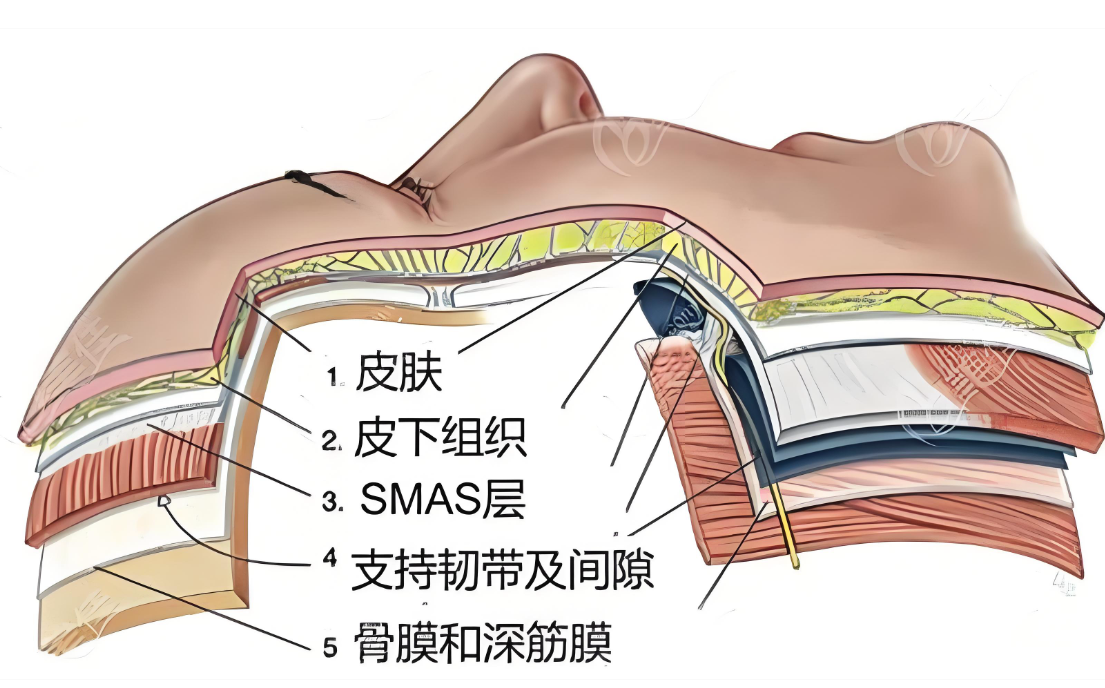 成都張艷峰醫(yī)生脂肪室復位口碑評價
