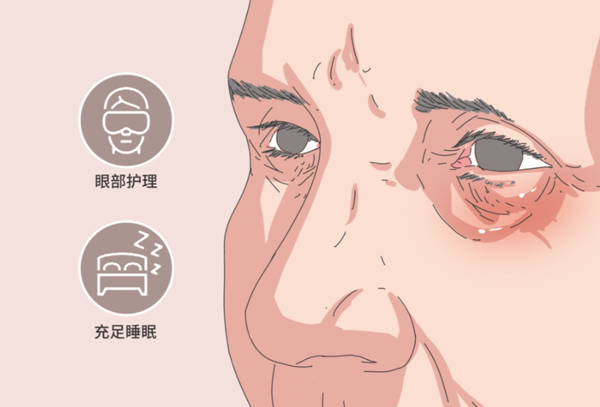 深圳朱冠峰眼袋手術(shù)怎么預(yù)約掛號(hào)