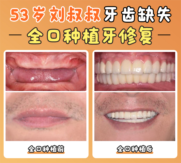 四、廣州柏德口腔可靠嗎？醫(yī)生團隊展專精