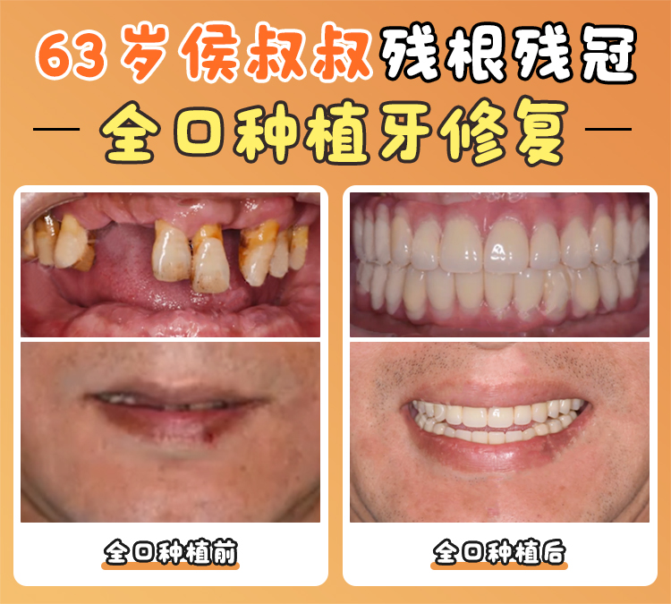 五、廣州柏德口腔可靠嗎？價格透明有保護