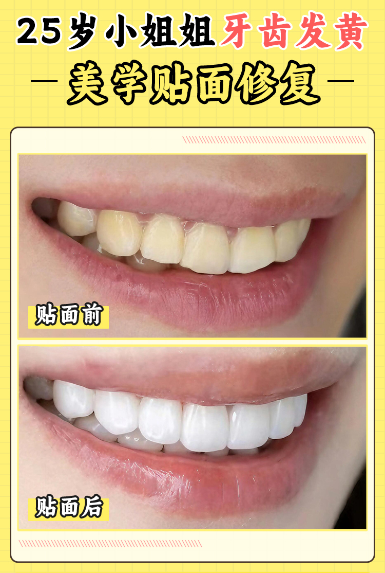 一、深圳正恩牙科醫(yī)院簡介