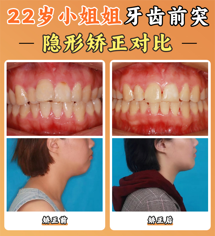 四、深圳正恩牙科醫(yī)院優(yōu)勢技術(shù)