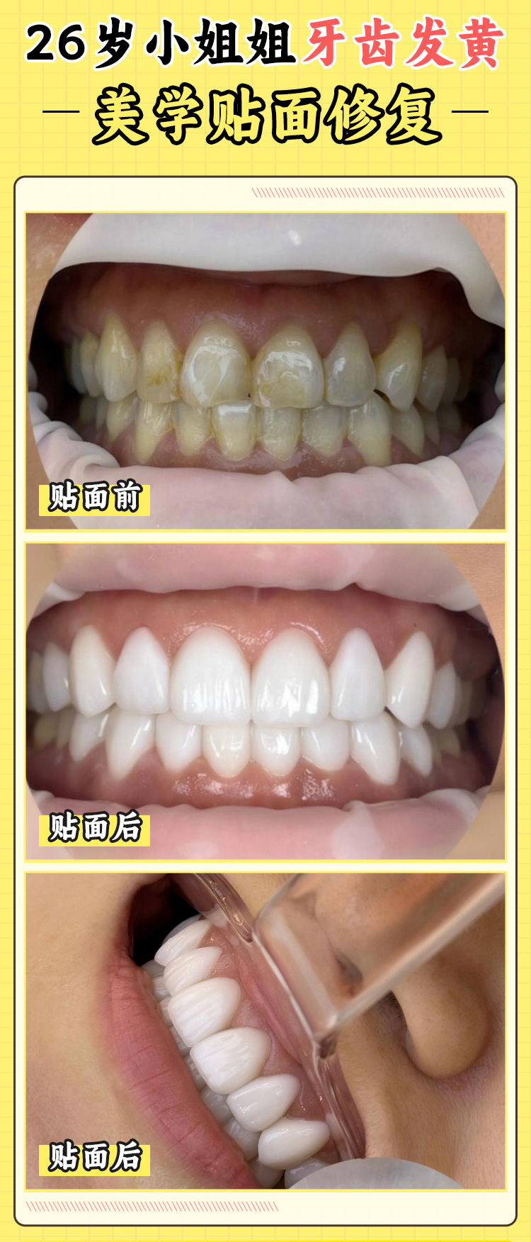 五、深圳正恩牙科醫(yī)院避坑指南
