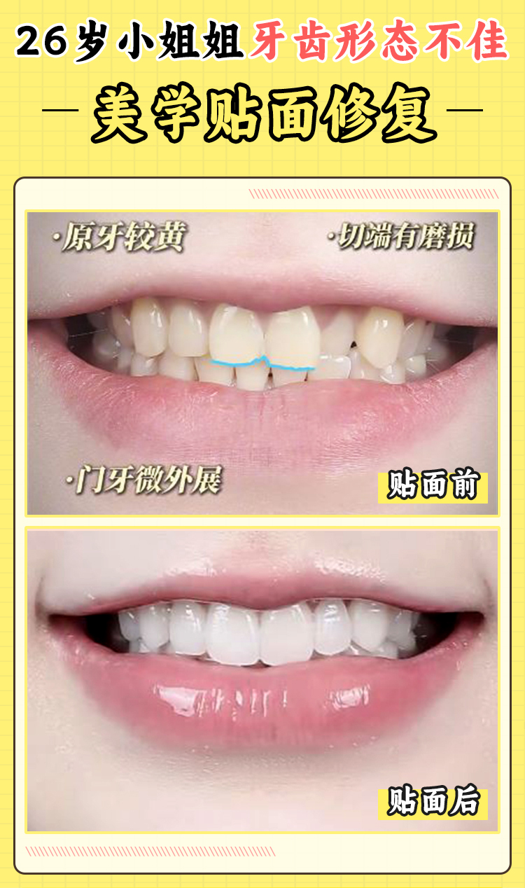 二、東莞健力口腔醫(yī)院是國有還是私立之與國有醫(yī)院的區(qū)別