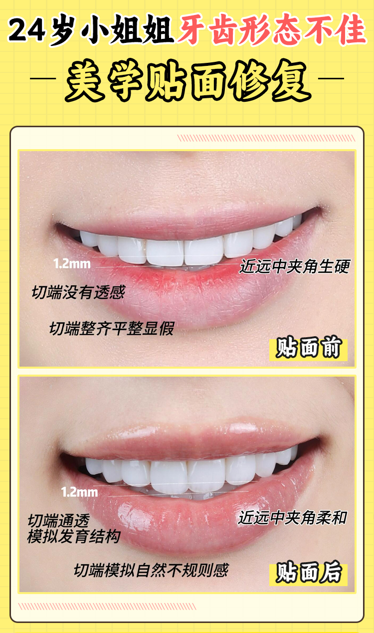 三、東莞健力口腔醫(yī)院是國有還是私立之醫(yī)院的正規(guī)性與優(yōu)勢(shì)