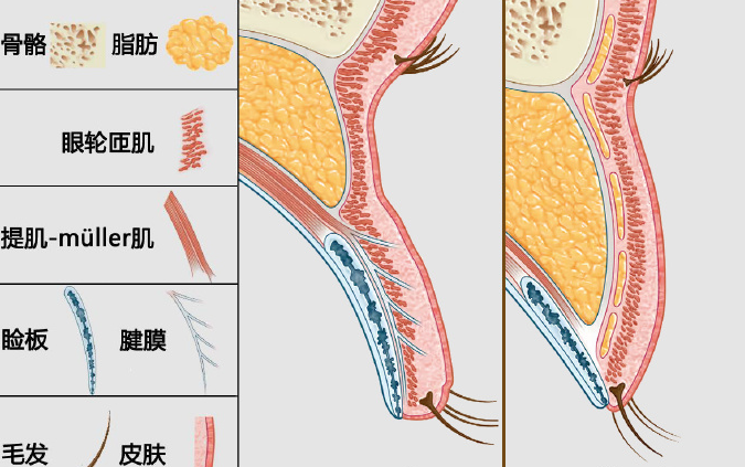 上海高影医生双眼皮手术过程图