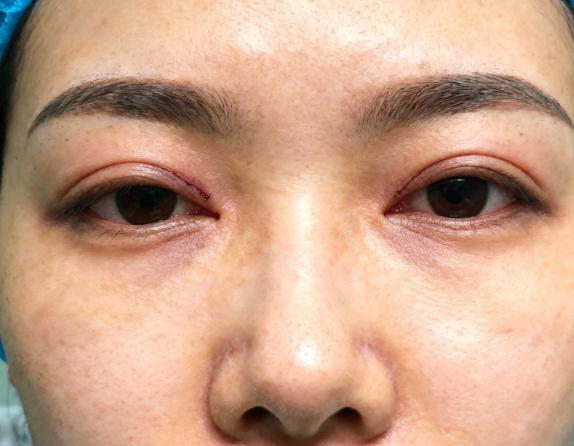 实例二:多次失败修复后的“烂摊子”