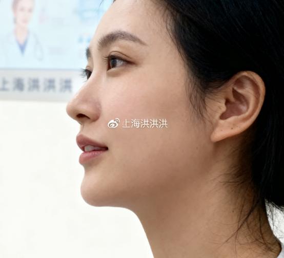 为什么王洪的取出能“不留疤”