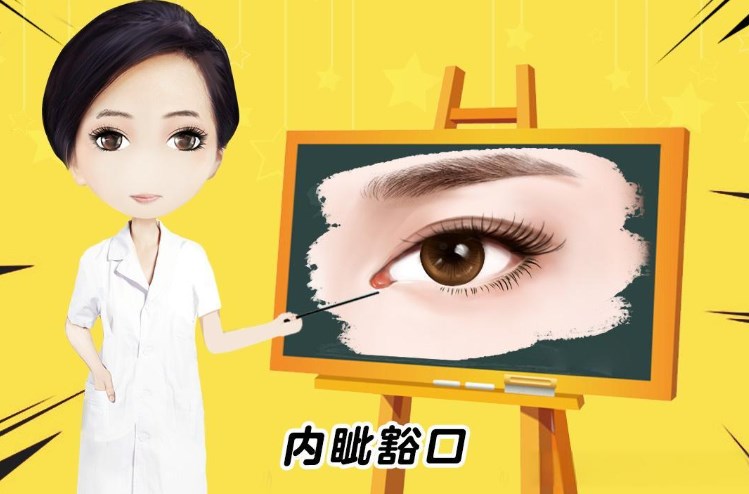 上海内眼角回包修复排行前三