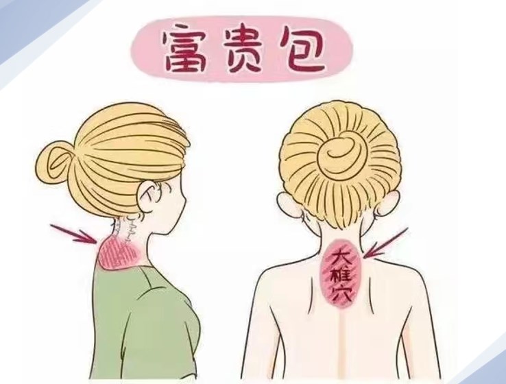 李方伟做微创富贵包价格贵吗