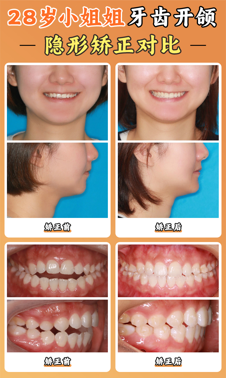 二、新北口腔(马连洼总店)医生靠谱吗