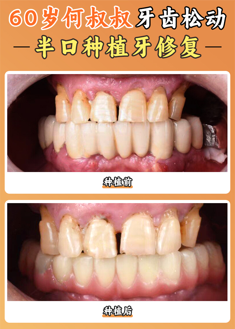 六、新北口腔(马连洼总店)的就诊便捷吗