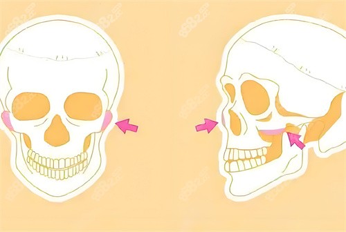 沈阳朱石江医生怎么样?凸嘴/磨骨技术靠谱,临床经验足!
