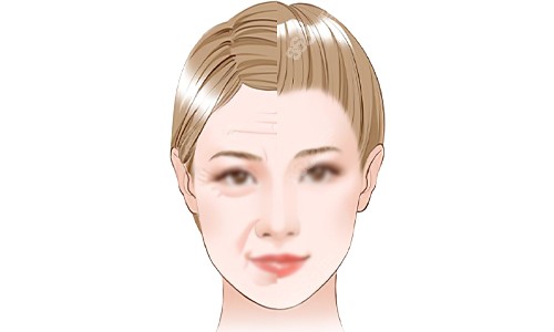 20251028377193.jpg 面部抗衰老的意義.jpg
