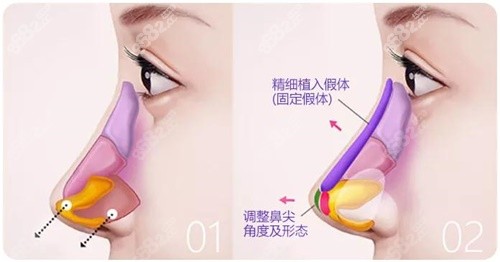 20251028533197.jpg 鼻綜合示意圖.jpg