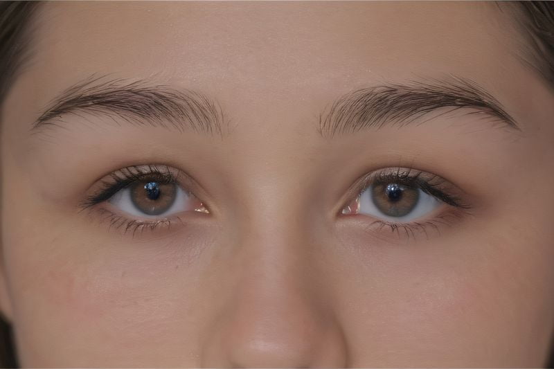 三、哈密愛爾眼科醫(yī)院的手術(shù)價格分析