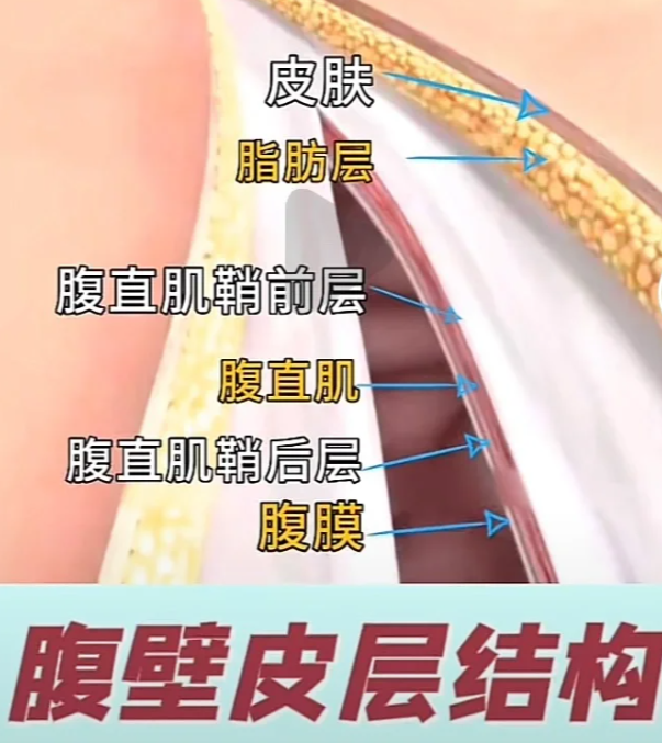 李献和医生腹壁整形成功实例:
