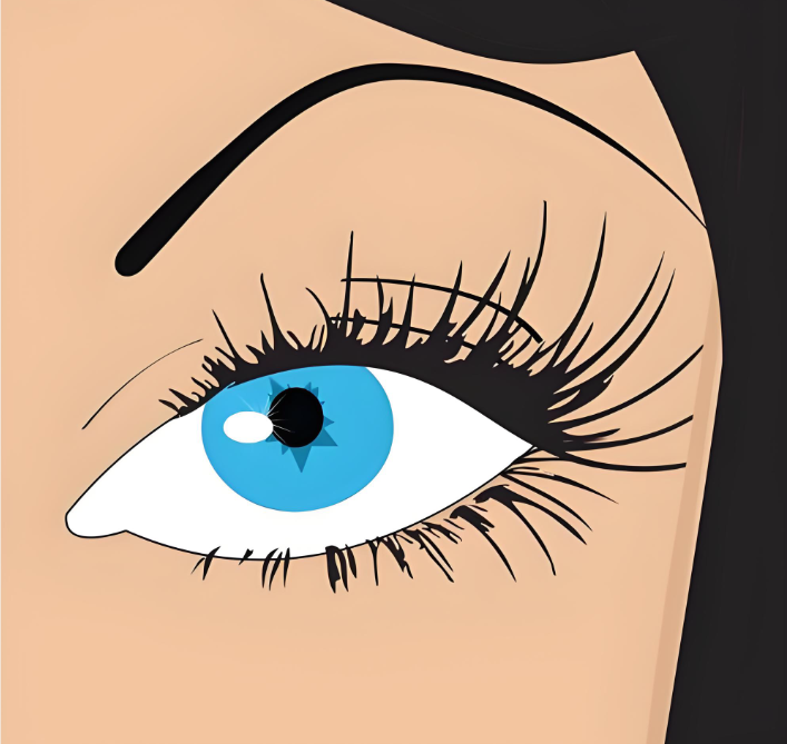 韓國雙眼皮不開刀到底是怎么做的www.66ub.cn