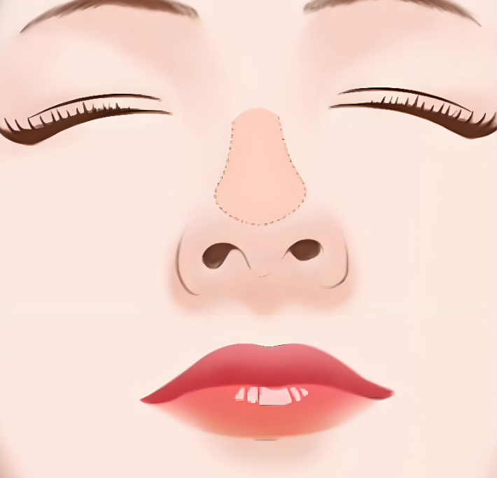 有在深圳文丰做过鼻子的吗www.8682.cc