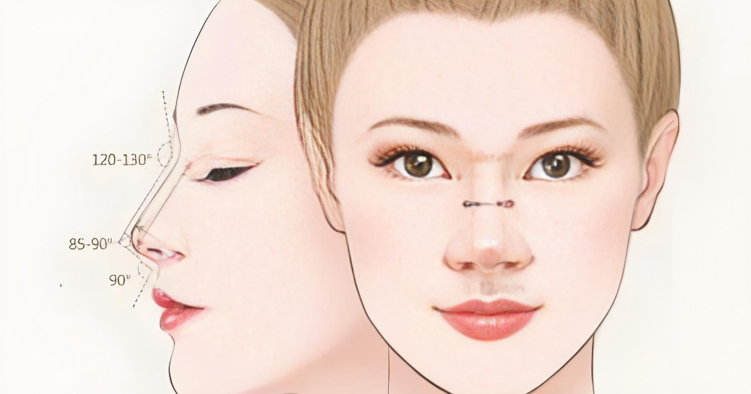 深圳文丰做鼻子靠谱吗