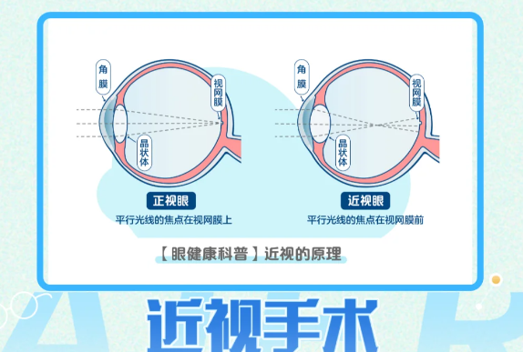 义乌视光眼科医院收费不贵