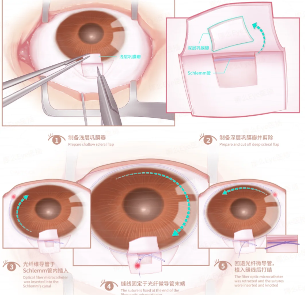 义乌视光眼科医院的“加分项”:除了医生,这些细节也让患者放心