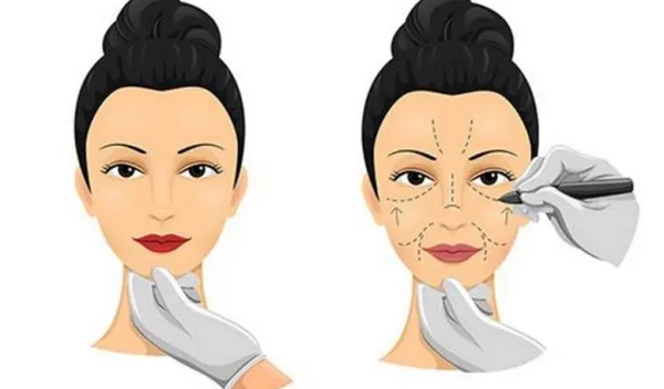 张楚擅长双眼皮手术