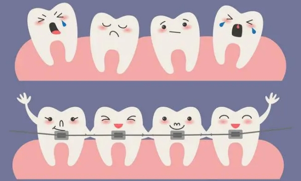 咿呀口腔金屬矯正價(jià)格5304元起：武漢分院真實(shí)收費(fèi)，比公立省一半