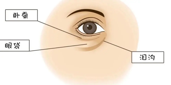 深圳健麗醫(yī)美眼袋外切