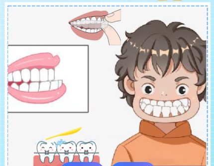 侯振杰正牙为何立马有效果?技术学名为牙槽骨定位整形,矫正时间短,2025年临床数据超亮眼