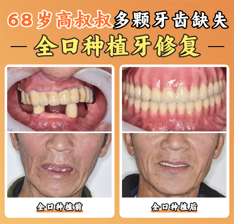 二、溫州存濟口腔醫(yī)院的優(yōu)勢