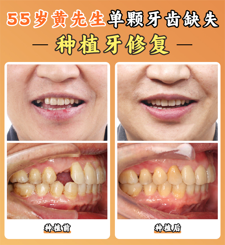 三、溫州存濟口腔醫(yī)院的診療項目及價格