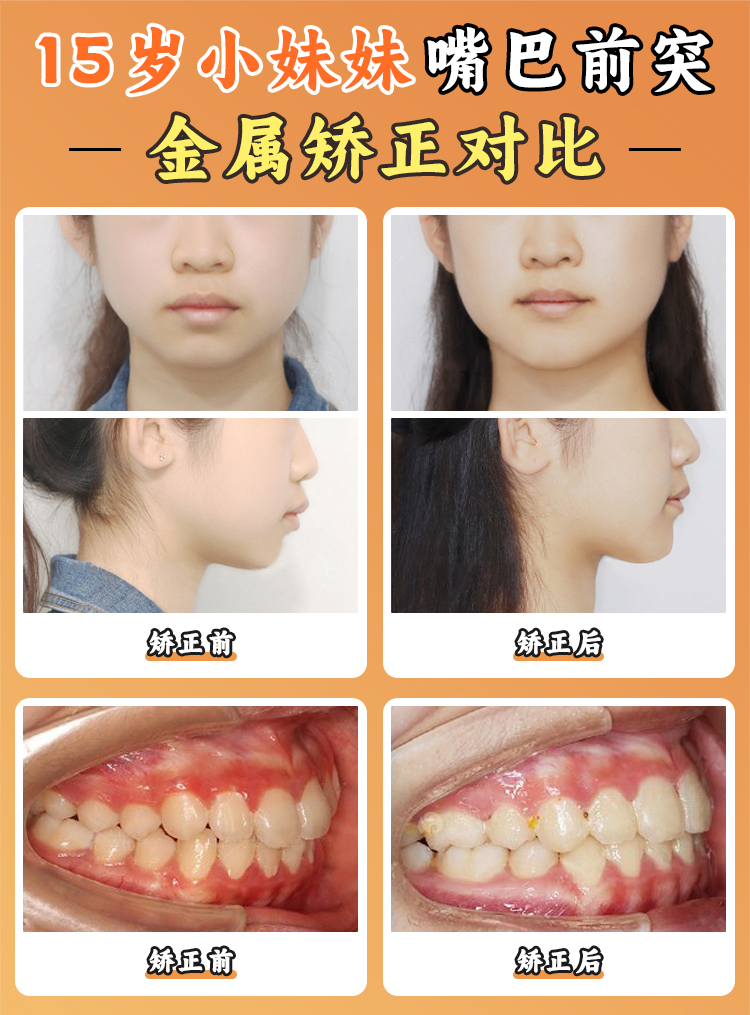 乐清齿逸口腔医生简介：龚博林等多位专家，精通正畸种植，为您口腔健康保驾护航！ 