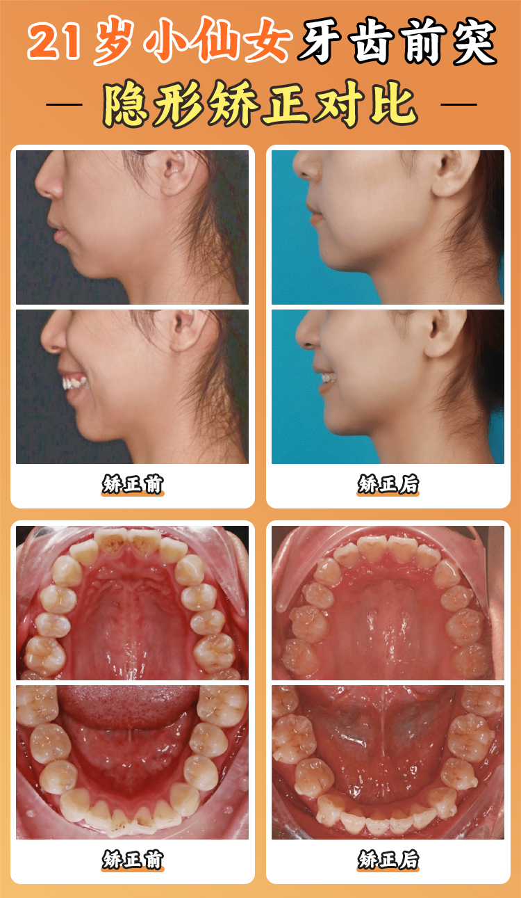 三、嘉興圣禾口腔綜合科項(xiàng)目?jī)r(jià)格