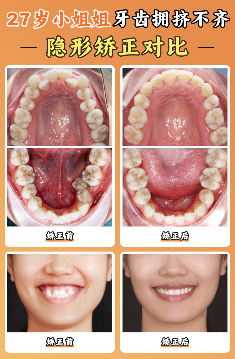 五、選擇深圳格倫菲爾口腔門診部的優(yōu)勢