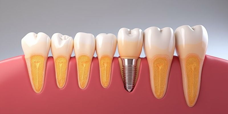 mis种植体三种档次价格