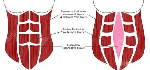 梁紅偉腹壁成形費(fèi)用表